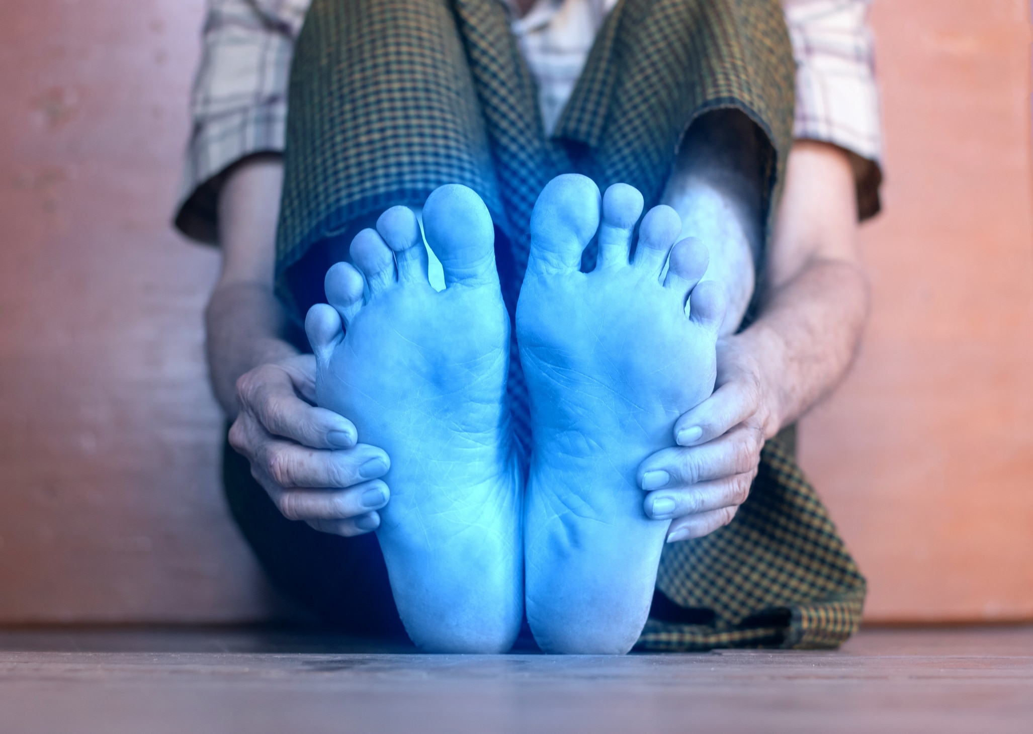 Light blue colored feet of Asian man. Concept of tingling and numbness or cold and clumsy foot. Light blue colored feet of Asian elder man. Concept of tingling and numbness or cold and clumsy foot.